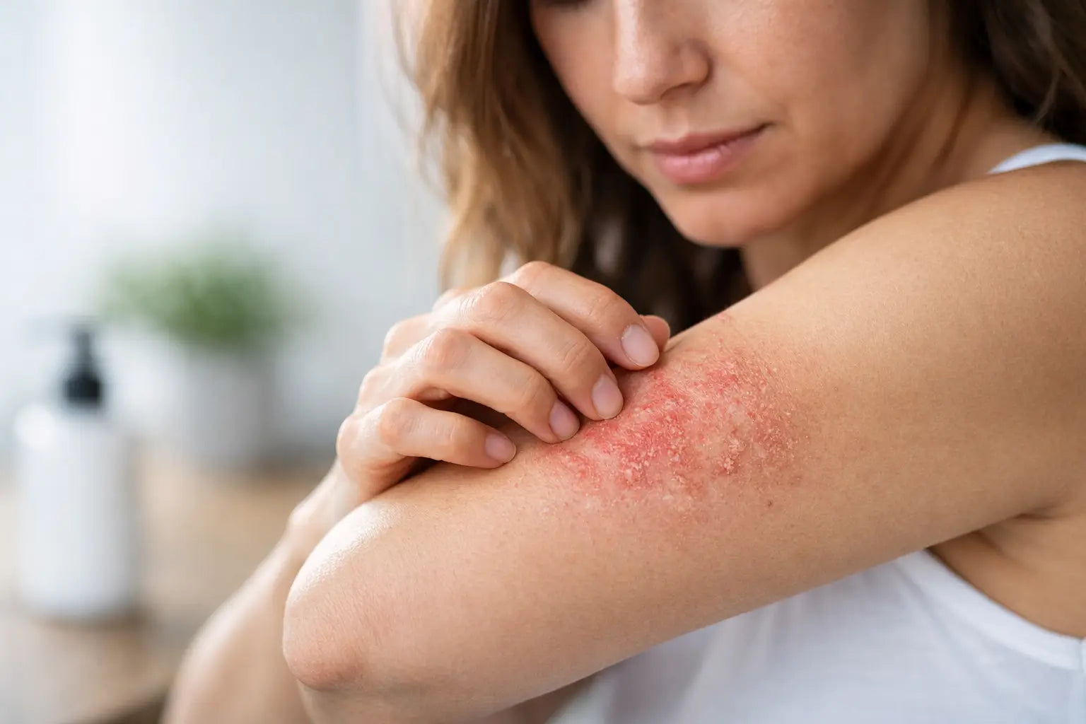 Eczema Skin Symptoms You Shouldn’t Ignore
