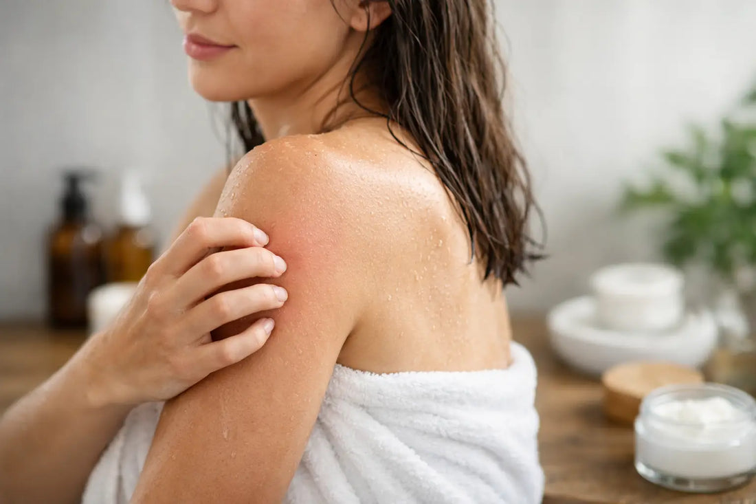 How to Soothe Itchy Skin After Shower