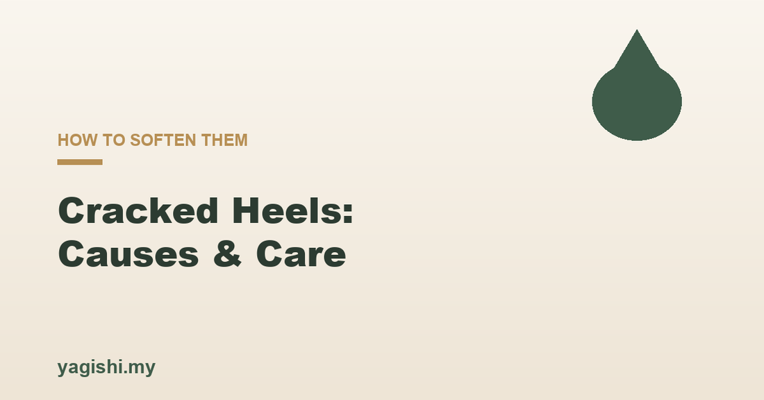Cracked heels causes and how to soften them, Yagishi blog feature image