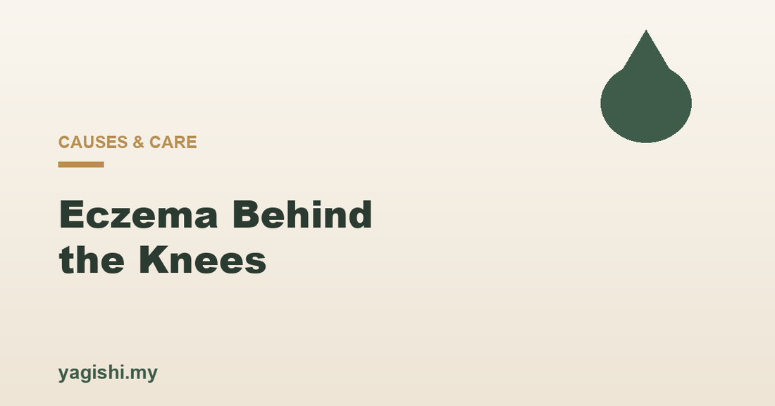 Eczema behind the knees causes and daily care - Yagishi guide