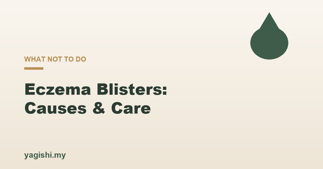 Eczema blisters causes treatment and what not to do - Yagishi guide