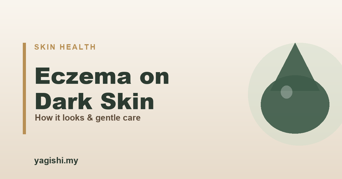 Eczema on dark and brown skin, how it looks and gentle care - Yagishi