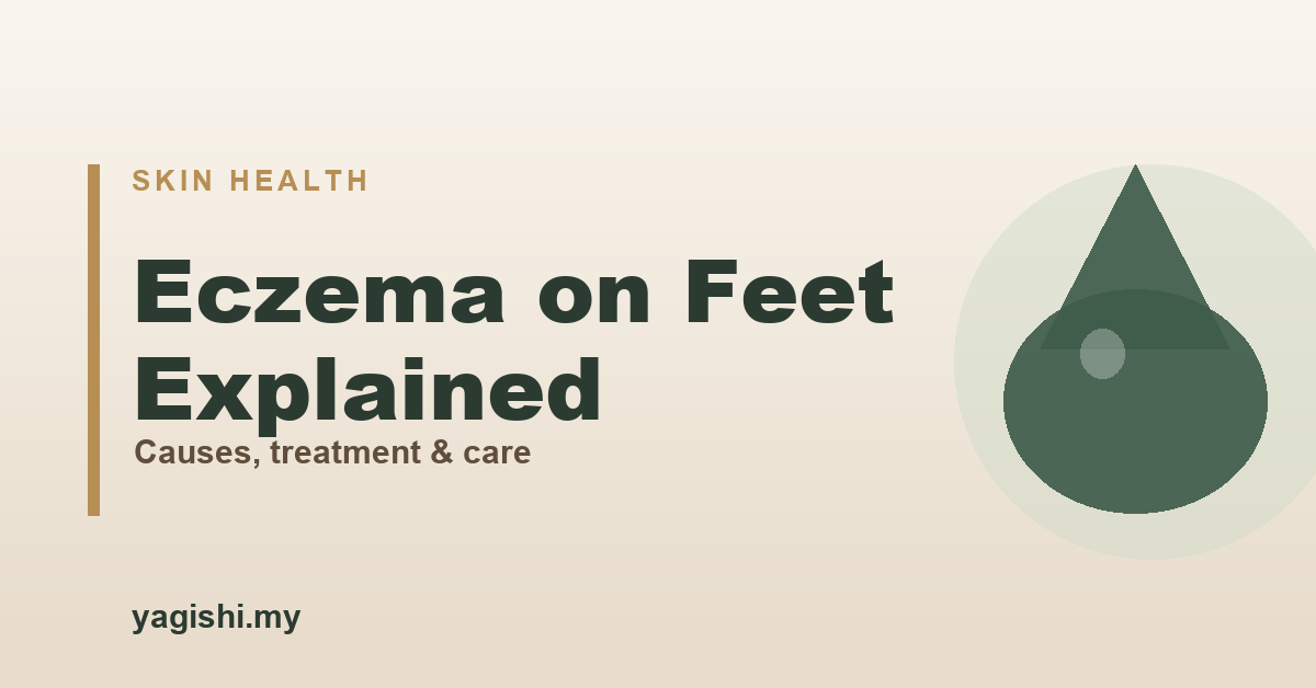 Eczema on feet causes, symptoms, treatment and daily care - Yagishi guide