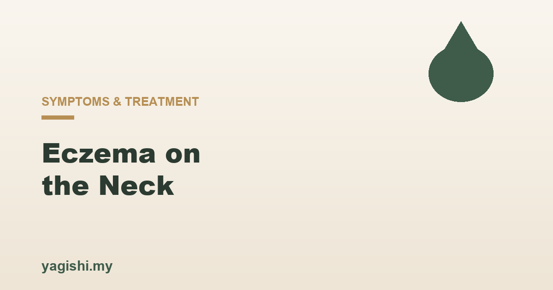 Eczema on the neck symptoms treatment and prevention - Yagishi guide