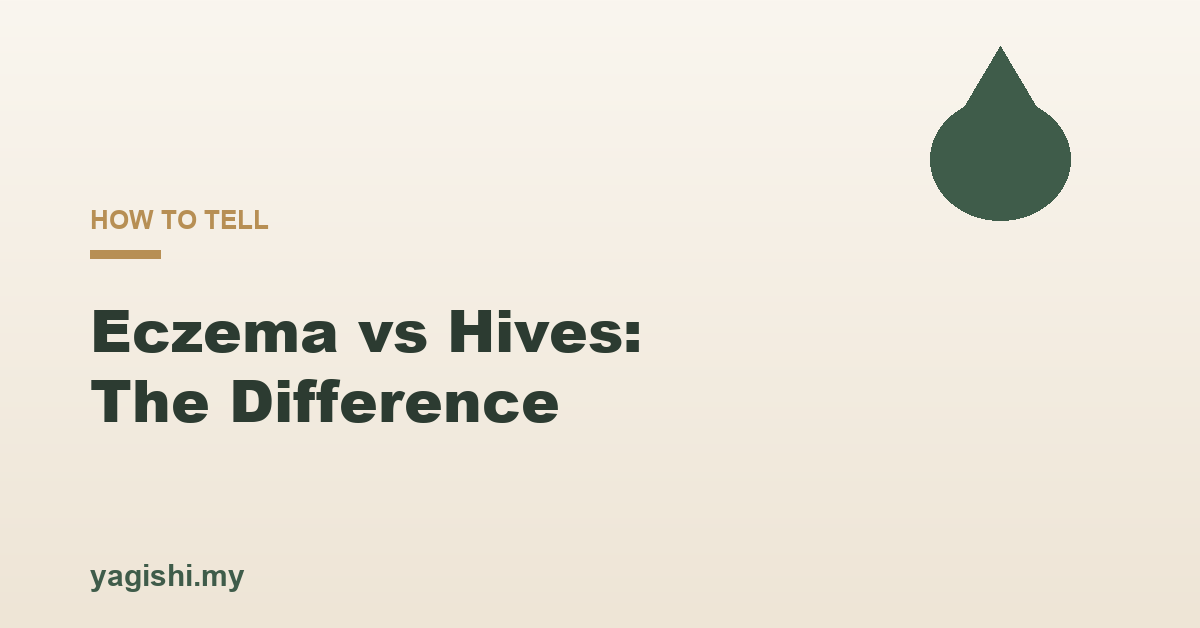 Eczema vs hives how to tell the difference - Yagishi guide
