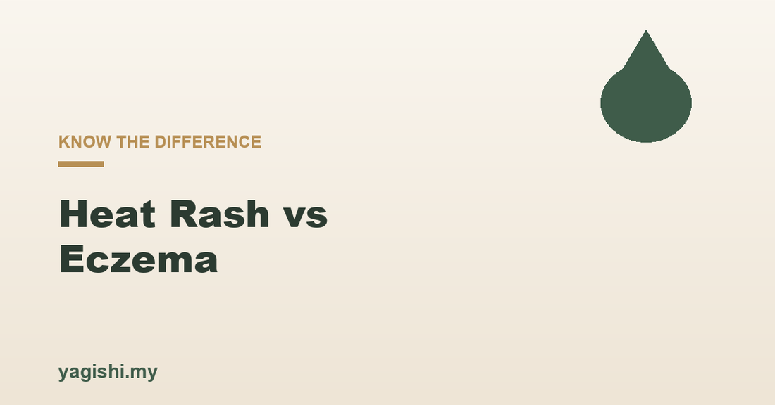 Heat rash vs eczema differences causes and treatment - Yagishi guide