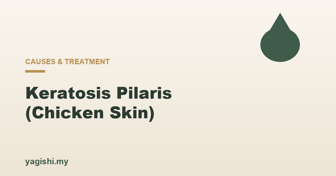 Keratosis pilaris chicken skin causes and how to smooth it - Yagishi guide