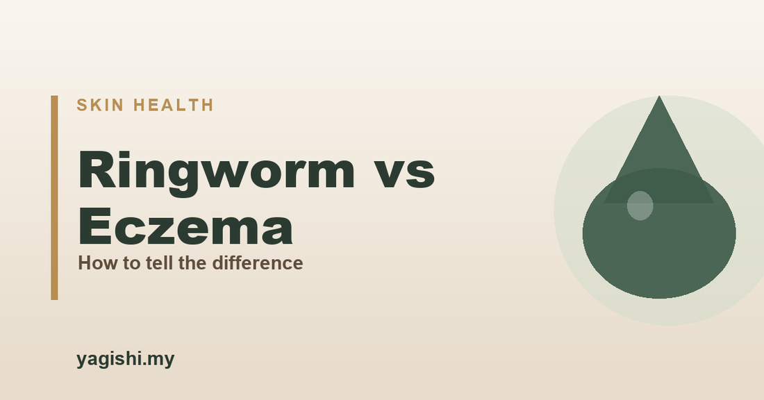 Ringworm vs eczema - how to tell the difference - Yagishi guide