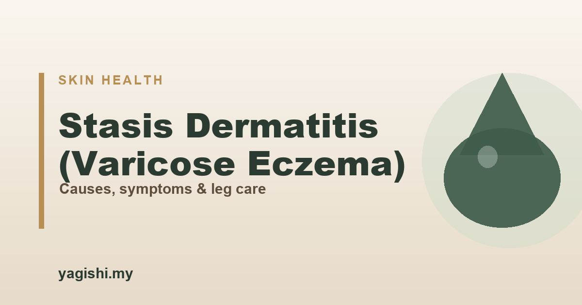 Stasis dermatitis (varicose eczema) causes, symptoms and treatment - Yagishi guide