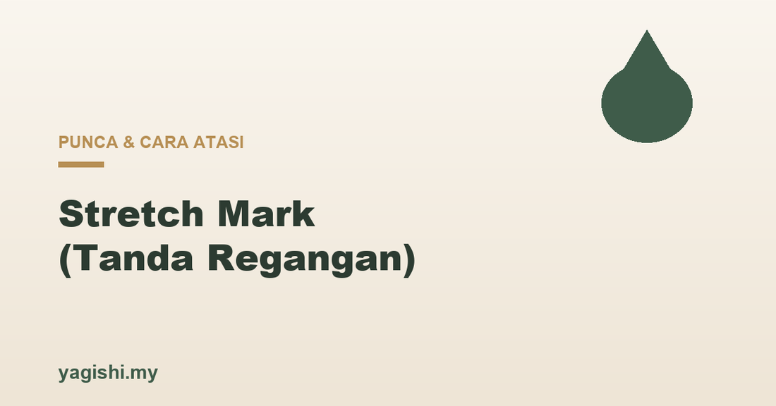 Stretch mark tanda regangan punca dan cara kurangkan - panduan Yagishi