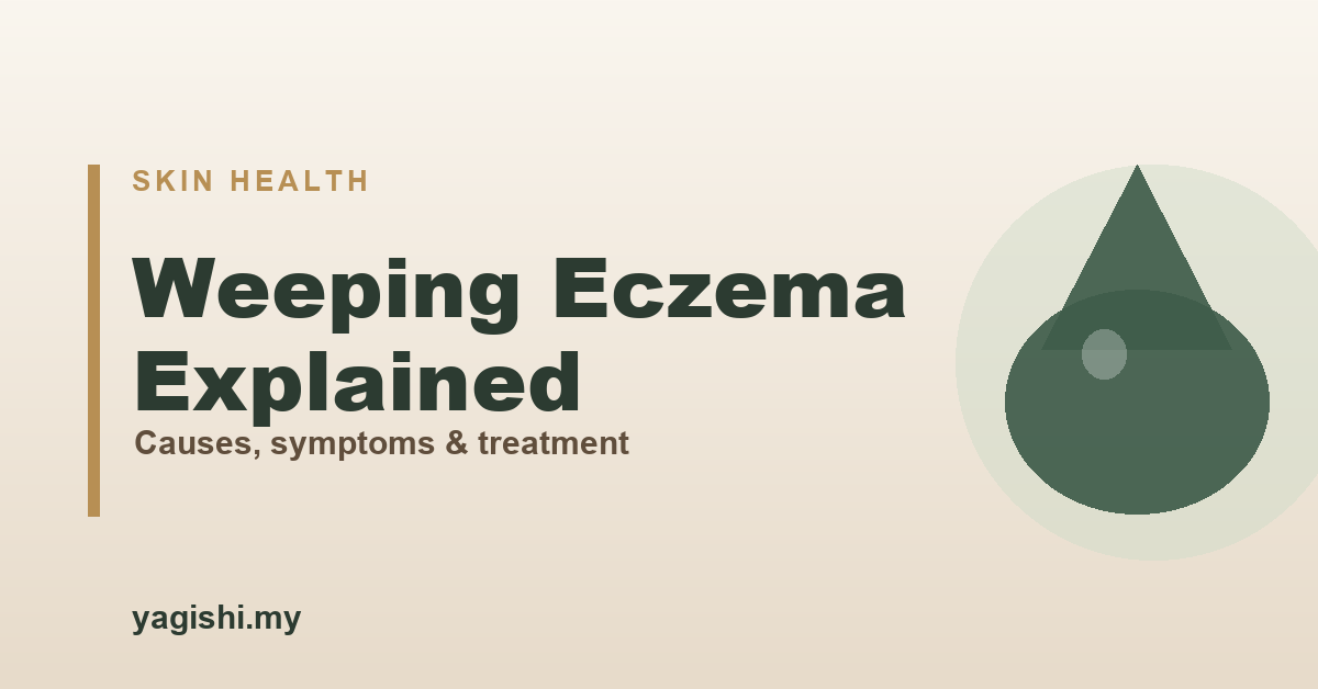 Weeping eczema explained - causes, symptoms and treatment - Yagishi