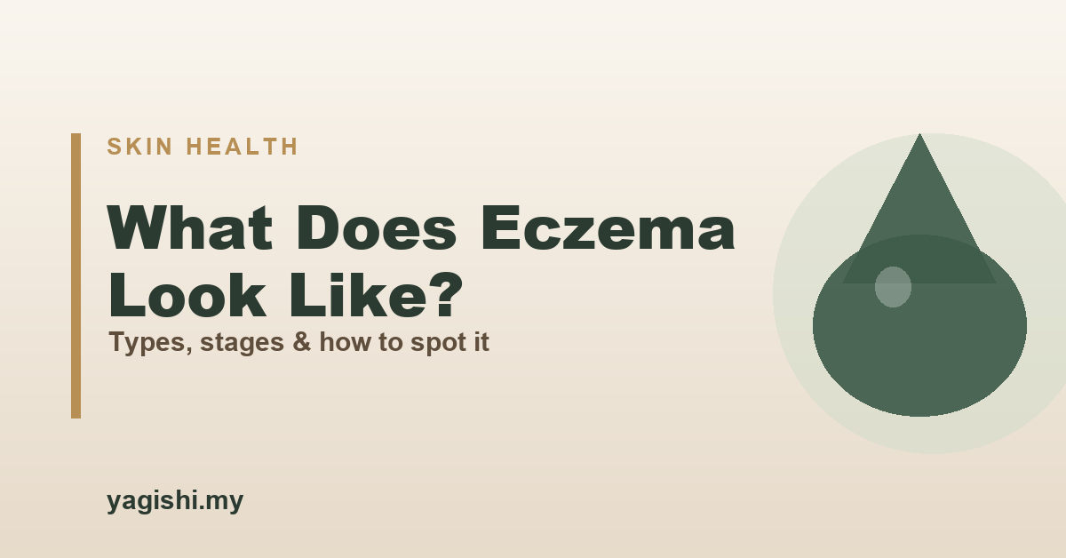 What does eczema look like - types, stages and pictures - Yagishi guide