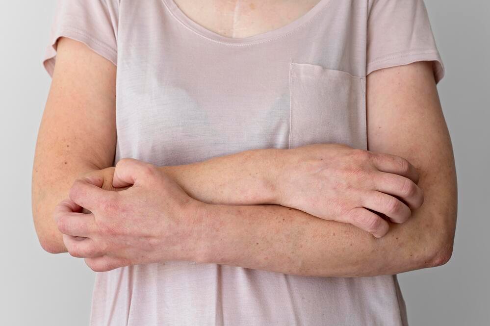 A woman scratching the her hand due to her eczema symptoms on skin