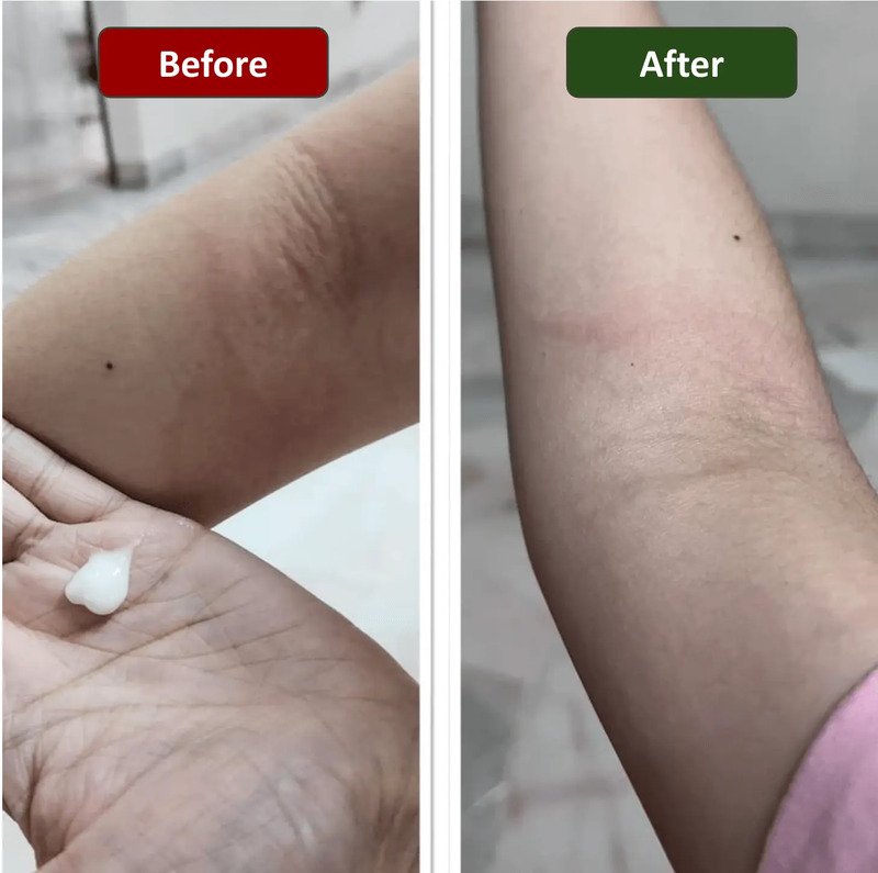 Customer review after using Yagishi Lotion