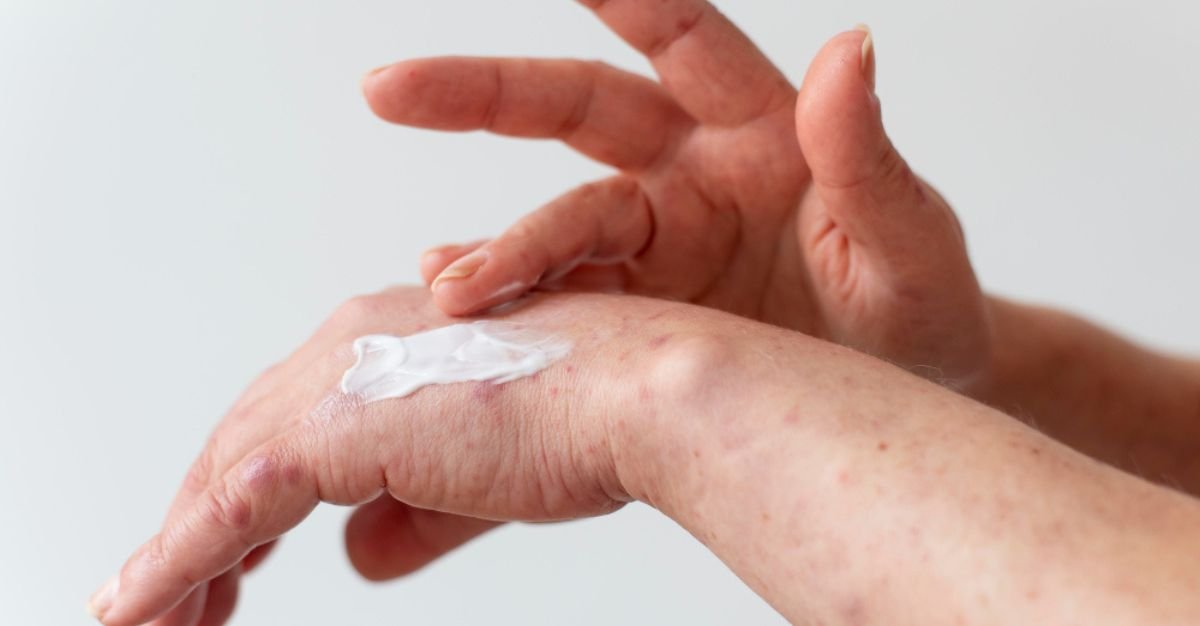 The Best Lotion For Cracked Hands And Feet In Malaysia